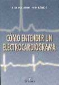 Cómo entender un electrocardiograma Cómo entender un electrocardiograma