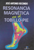 Resonancia magnética en tobillo-pie