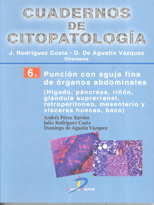 Punción con aguja fina de órganos abdominales: Cuadernos de Citopatología. No 6