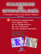 Punción aspiración con aguja fina en el diagnóstico de los tumores de los tejidos blandos: Cuadernos de Citopatología. No 8