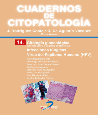 Citología ginecológica. Infecciones fúngicas. Virus del papiloma humano: Cuadernos de Citopatología. No 14