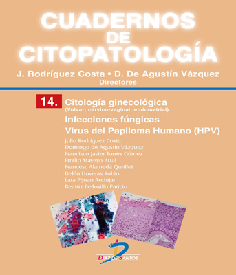 Portada de Citología ginecológica. Infecciones fúngicas. Virus del papiloma humano