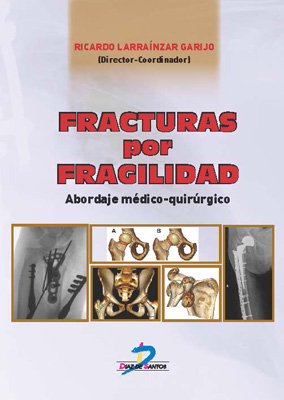 Fracturas por fragilidad: Abordaje médico quirúrgico