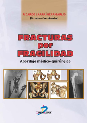 Fracturas por fragilidad: Abordaje médico quirúrgico Fracturas por fragilidad: Abordaje médico quirúrgico