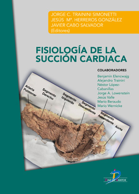 Fisiología de la succión cardiaca Fisiología de la succión cardiaca