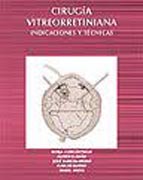 Cirugía Vitreorretiniana. Indicaciones y técnicas