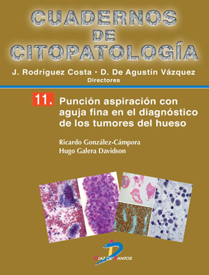 Punción aspiración con aguja fina en el diagnóstico de los tumores de hueso: Cuadernos de Citopatología. No 11