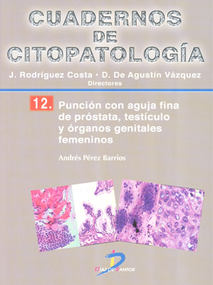 Punción con aguja fina de próstata, testículo y órganos genitales femeninos: Cuadernos de Citopatología No 12
